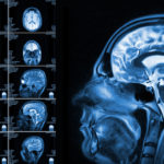 MRI brain scan MRI brain scan
